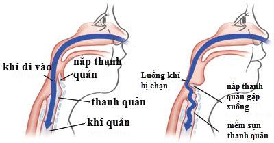 Cách kiểm tra khiếm khuyết bẩm sinh khó phát hiện ở trẻ nhỏ - Ảnh 1.