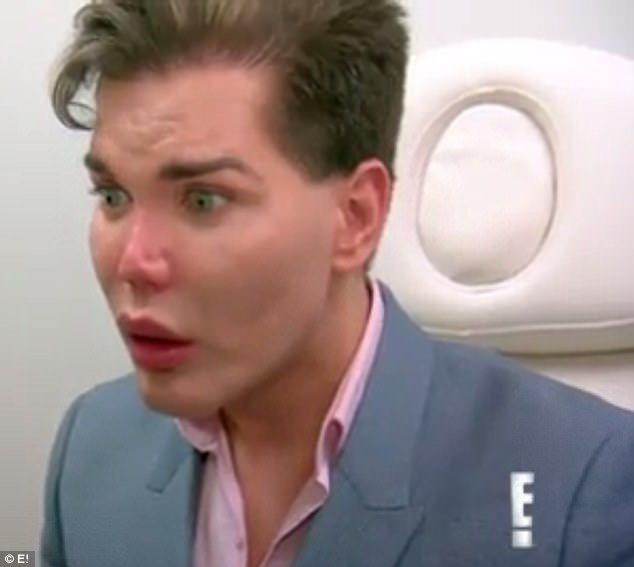 Mũi của búp bê sống Rodrigo Alves có thể rơi ra - Ảnh 6. Mũi của búp bê sống Rodrigo Alves có thể rơi ra - Ảnh 6.