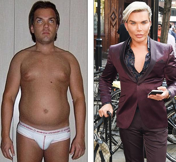 Mũi của búp bê sống Rodrigo Alves có thể rơi ra - Ảnh 14. Mũi của búp bê sống Rodrigo Alves có thể rơi ra - Ảnh 14.