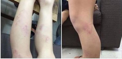 Chủ tịch Hà Nội yêu cầu làm rõ vụ 11 học sinh lớp 2 bị giáo viên đánh - Ảnh 1.