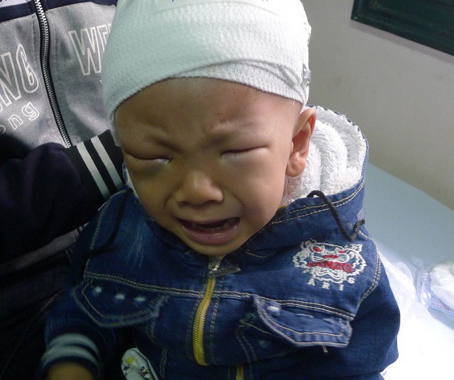 Đau đớn cảnh mẹ ung thư hạch, con ung thư võng mạc - Ảnh 1. Đau đớn cảnh mẹ ung thư hạch, con ung thư võng mạc - Ảnh 1.
