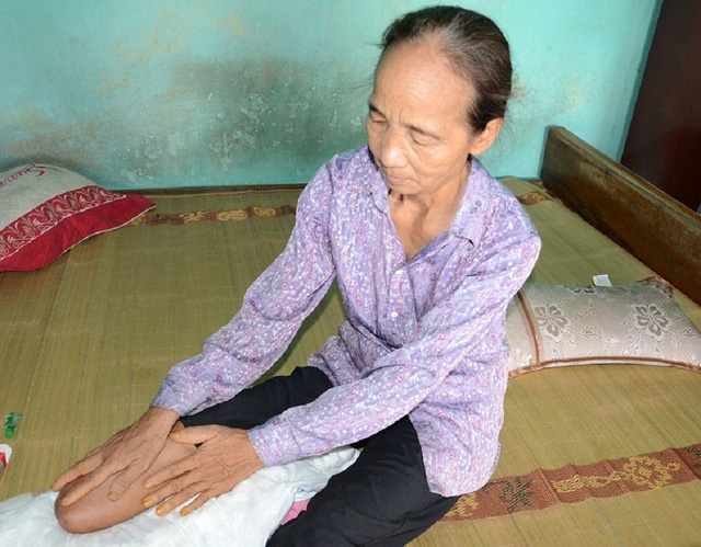 Đi thăm con trai bị tâm thần, mẹ gặp tai nạn phải cưa bỏ 1 chân - Ảnh 6. Đi thăm con trai bị tâm thần, mẹ gặp tai nạn phải cưa bỏ 1 chân - Ảnh 6.