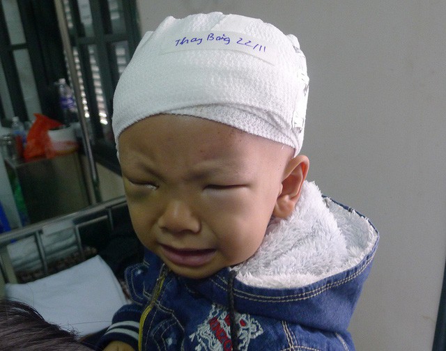 Đau đớn cảnh mẹ ung thư hạch, con ung thư võng mạc - Ảnh 7. Đau đớn cảnh mẹ ung thư hạch, con ung thư võng mạc - Ảnh 7.