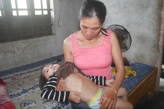 Thiếu 80 triệu đồng để thay khớp, bé gái 4 tuổi có nguy cơ bị bại liệt - Ảnh 3. Thiếu 80 triệu đồng để thay khớp, bé gái 4 tuổi có nguy cơ bị bại liệt - Ảnh 3.