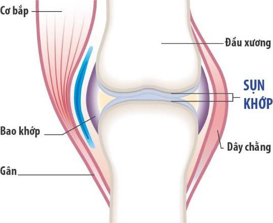 Một số sản phẩm bổ xương khớp cho người già tại cửa hàng Đồ Mỹ - Ảnh 1.