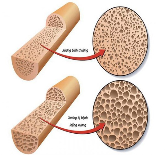 Ăn vỏ trứng: Tác dụng và tác hại cần lưu ý - Ảnh 3.