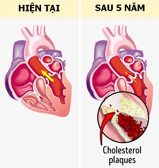 Chuyên gia cảnh báo những tác hại khôn lường của thói quen ngồi nhiều, lười vận động - Ảnh 2.