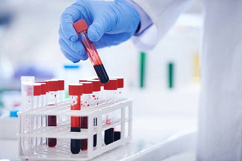 X&eacute;t nghiệm CEA để ph&aacute;t hiện ung thư - Ảnh 1.