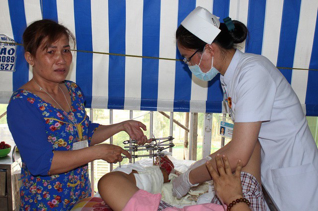 Người mẹ trẻ sắp mất chân trong cảnh gia đình khánh kiệt - Ảnh 3.