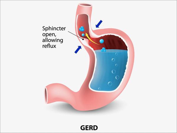 Ho dai dẳng không đơn giản như bạn nghĩ - Ảnh 1.