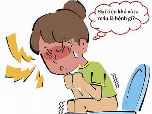 5 triệu chứng viêm đại tràng không thể bỏ qua - Ảnh 1. 5 triệu chứng viêm đại tràng không thể bỏ qua - Ảnh 1.