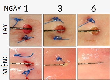 Tại sao vết thương ở miệng nhanh lành hơn ở vùng da khác? - Ảnh 2.