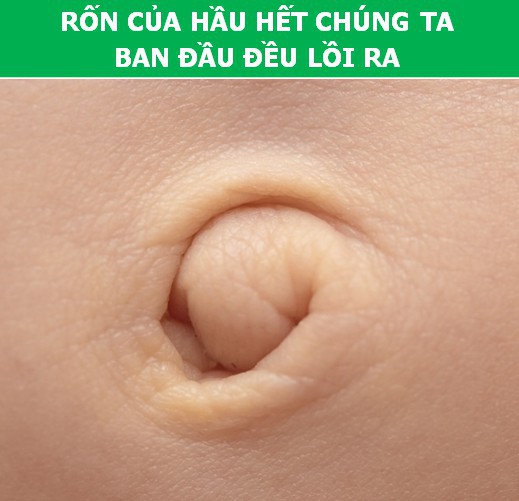 Bất ngờ trước những sự thật khoa học về… chiếc rốn - Ảnh 5.