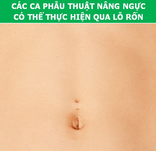 Bất ngờ trước những sự thật khoa học về… chiếc rốn - Ảnh 7.