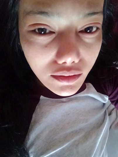Rụng toàn bộ lông mi vì nối mi ở tiệm - Ảnh 4.