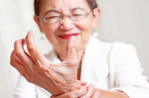 Phụ nữ chớ chủ quan với bệnh gout - Ảnh 1. Phụ nữ chớ chủ quan với bệnh gout - Ảnh 1.