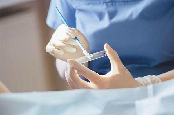 X&eacute;t nghiệm cần l&agrave;m để ph&aacute;t hiện ung thư cổ tử cung - Ảnh 1.