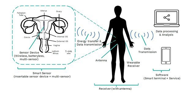 Thiết bị mới có khả năng phát hiện vô sinh - Ảnh 3. Thiết bị mới có khả năng phát hiện vô sinh - Ảnh 3.