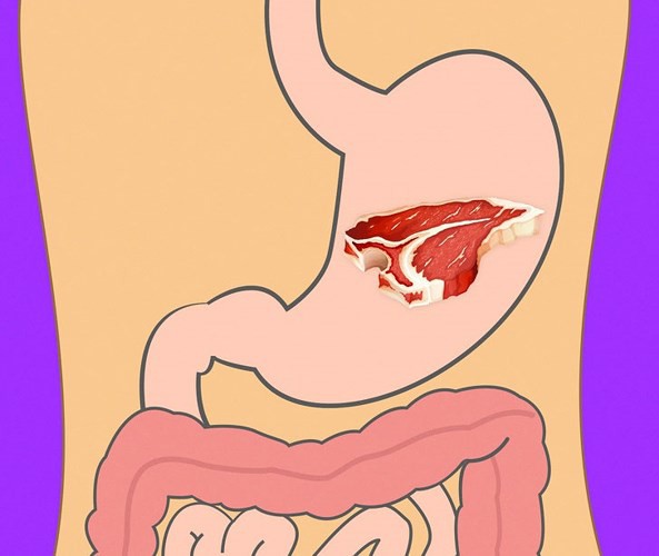 Mất bao lâu để tiêu hóa hết thực phẩm ăn hàng ngày? - Ảnh 15.