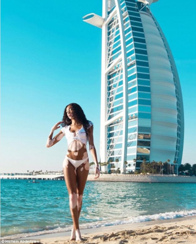 Winnie Harlow khoe dáng thon gọn - Ảnh 8. Winnie Harlow khoe dáng thon gọn - Ảnh 8.
