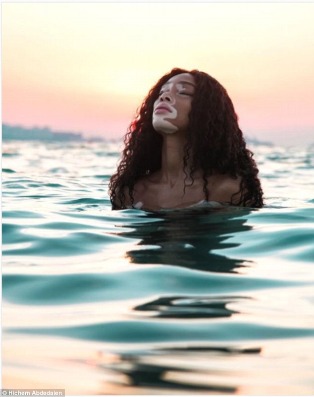 Winnie Harlow khoe dáng thon gọn - Ảnh 12. Winnie Harlow khoe dáng thon gọn - Ảnh 12.