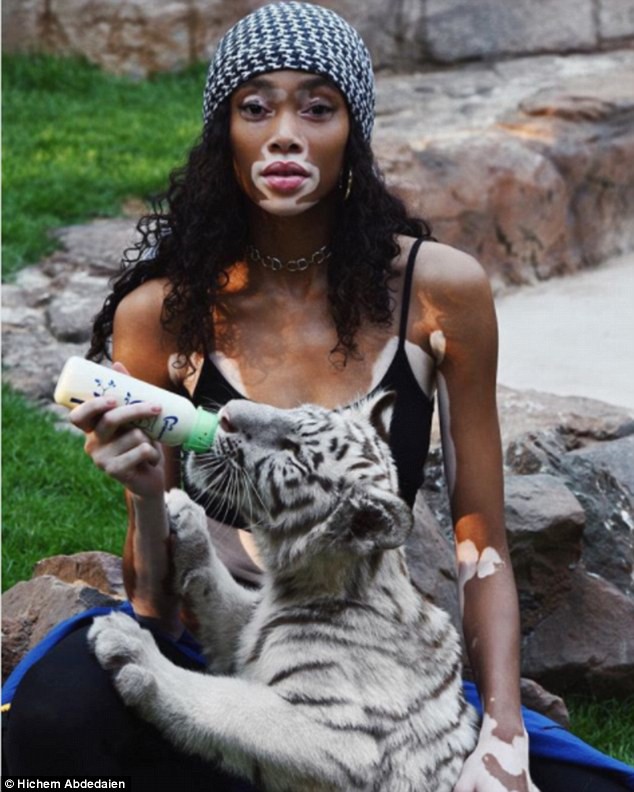 Winnie Harlow khoe dáng thon gọn - Ảnh 16. Winnie Harlow khoe dáng thon gọn - Ảnh 16.