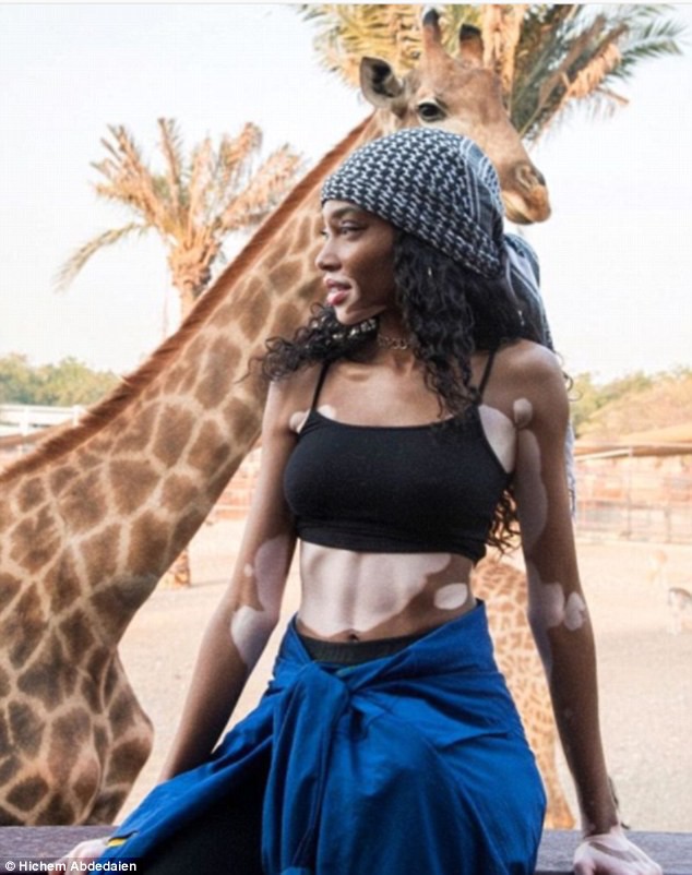 Winnie Harlow khoe dáng thon gọn - Ảnh 18. Winnie Harlow khoe dáng thon gọn - Ảnh 18.