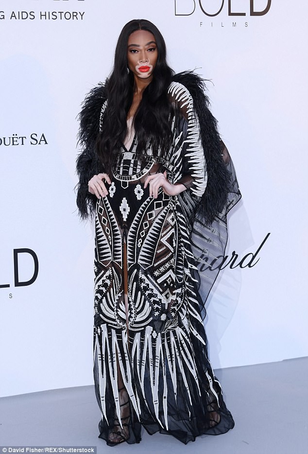 Si&ecirc;u mẫu bị bạch biến khoe d&aacute;ng gợi cảm - Ảnh 4.