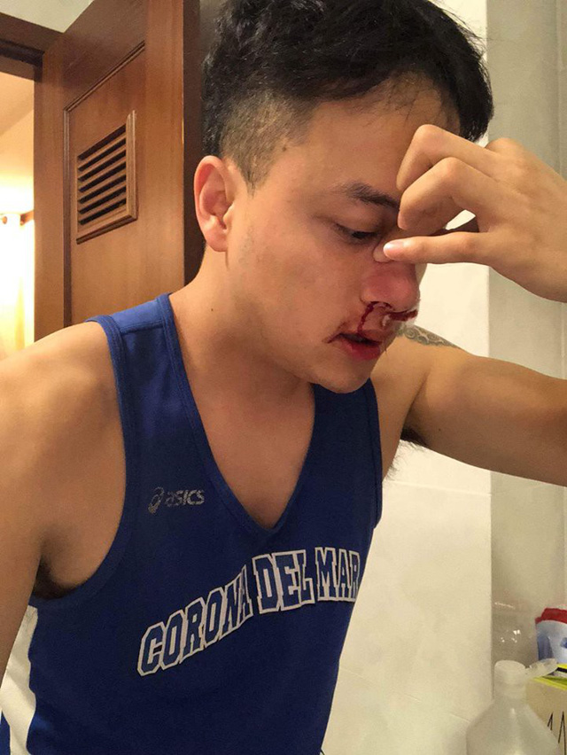 Cao Thái Sơn phải đi cấp cứu lúc nửa đêm vì chảy máu mũi - Ảnh 2. Cao Thái Sơn phải đi cấp cứu lúc nửa đêm vì chảy máu mũi - Ảnh 2.