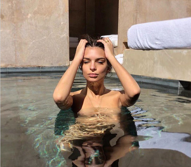 Tại sao ng&ocirc;i sao thường tạo d&aacute;ng theo kiểu đau đầu khi chụp ảnh? - Ảnh 18.