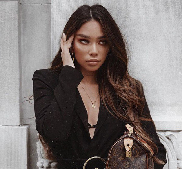 Tại sao ng&ocirc;i sao thường tạo d&aacute;ng theo kiểu đau đầu khi chụp ảnh? - Ảnh 20.