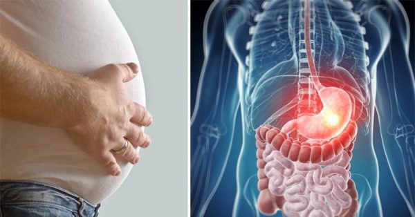 Cẩn trọng: Đầy hơi c&oacute; li&ecirc;n quan tới nhiều bệnh ung thư - Ảnh 2.