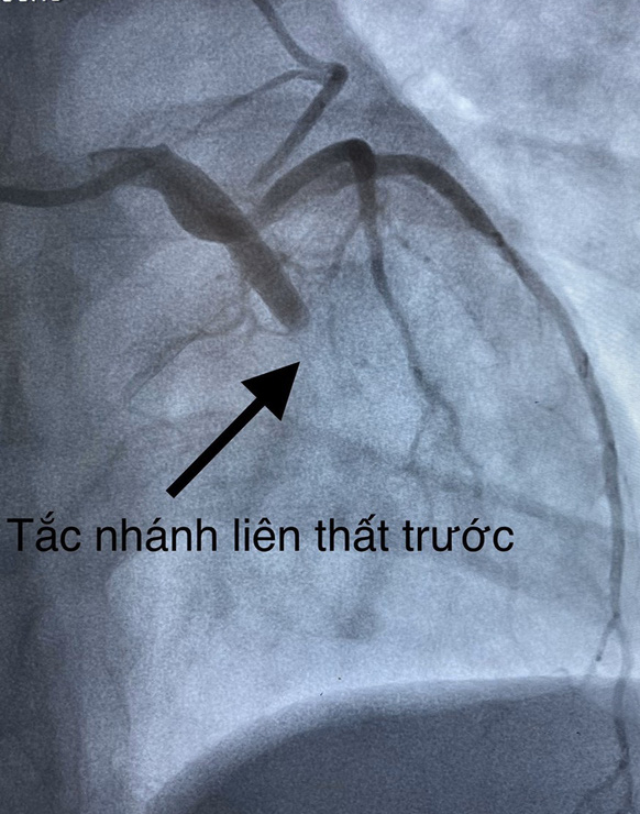 Cứu sống nam thanh niên 23 tuổi ngưng tim trong vòng 15 phút - Ảnh 2.