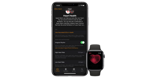 Apple Watch có thể mất tính năng phát hiện nhịp tim do kiện bản quyền? - Ảnh 1.