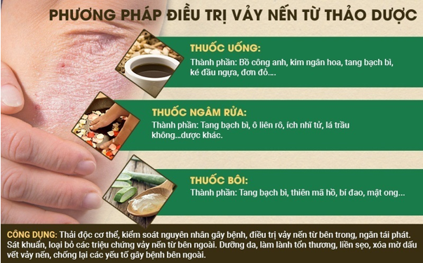 Bệnh vảy nến và cách điều trị hiệu quả, ngăn tái phát - Ảnh 2.