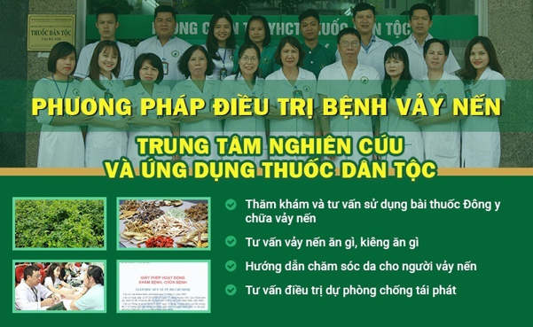 Bệnh vảy nến và cách điều trị hiệu quả, ngăn tái phát - Ảnh 3.