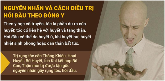 Hói đầu có chữa được không - Tiết lộ bí quyết của chuyên gia - Ảnh 2.