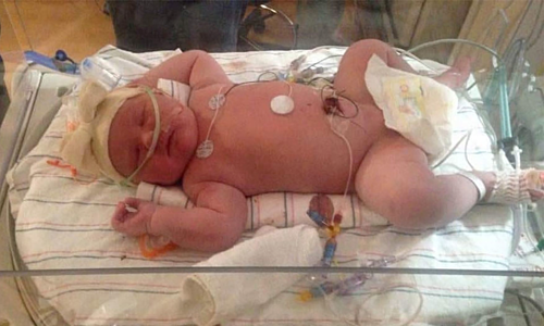 Mỹ: Em bé chào đời nặng gần 7 kg tại New York - Ảnh 1. Mỹ: Em bé chào đời nặng gần 7 kg tại New York - Ảnh 1.