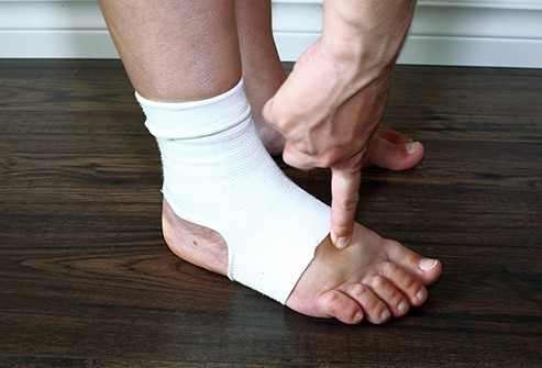Những nguyên nhân khiến bàn chân bị sưng tấy - Ảnh 12.