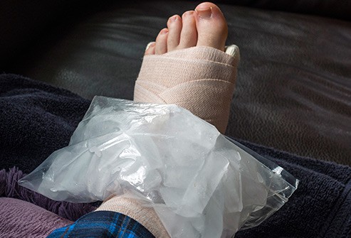 Những nguyên nhân khiến bàn chân bị sưng tấy - Ảnh 9.