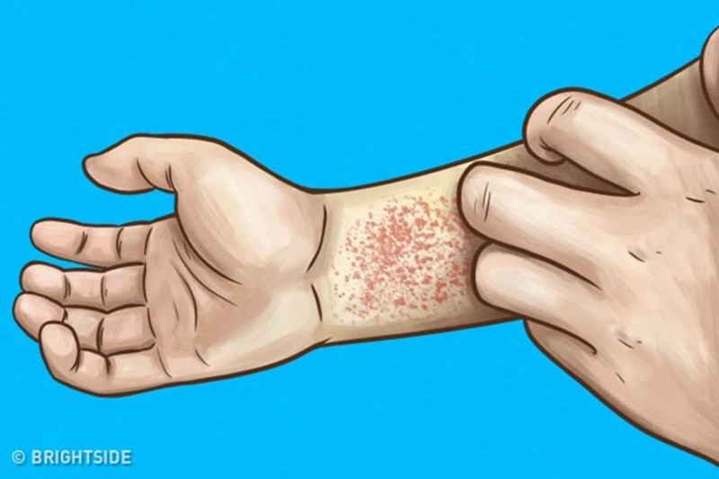 Báo động đỏ” cho thận khi bạn gặp những dấu hiệu này