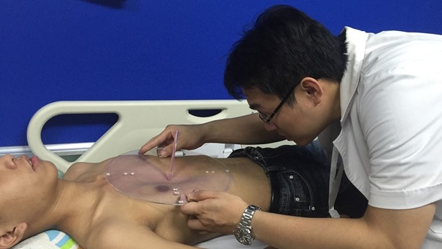 Đặt chu&ocirc;ng n&acirc;ng xương ức: Th&ecirc;m sự lựa chọn điều trị cho bệnh nhi l&otilde;m ức bẩm sinh - Ảnh 1.