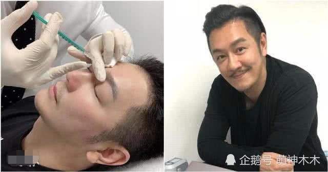 “Đoàn Dự” Trần Hạo Dân phẫu thuật thẩm mỹ níu giữ tuổi xuân - Ảnh 4.