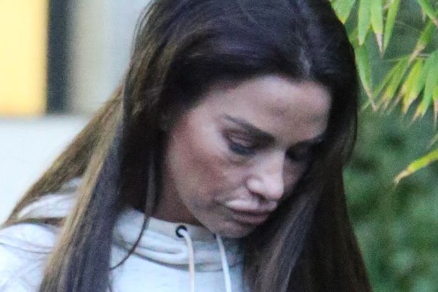 Katie Price tiếp tục làm đẹp bằng dao kéo - Ảnh 7. Katie Price tiếp tục làm đẹp bằng dao kéo - Ảnh 7.