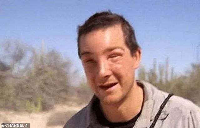 Chuyên gia sinh tồn Bear Grylls suýt mất mạng vì… ong đốt - Ảnh 2. Chuyên gia sinh tồn Bear Grylls suýt mất mạng vì… ong đốt - Ảnh 2.
