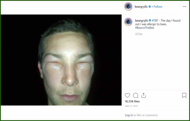 Chuyên gia sinh tồn Bear Grylls suýt mất mạng vì… ong đốt - Ảnh 3. Chuyên gia sinh tồn Bear Grylls suýt mất mạng vì… ong đốt - Ảnh 3.