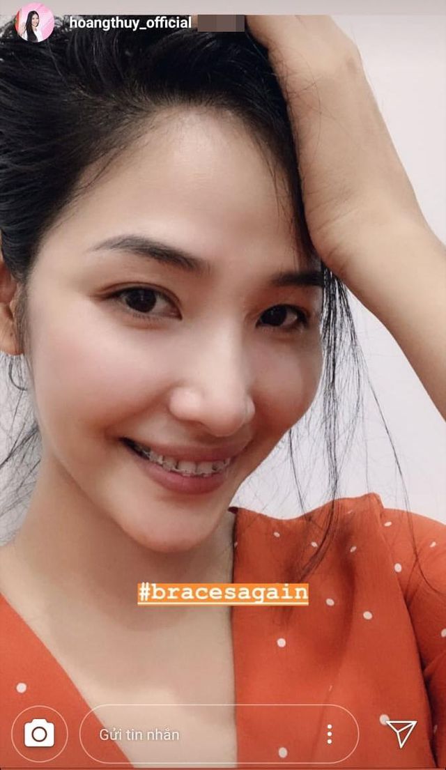 Hoàng Thuỳ khoe nhan sắc “lên hương” nhờ chỉnh răng trước thềm Miss Universe 2019 - Ảnh 4. Hoàng Thuỳ khoe nhan sắc “lên hương” nhờ chỉnh răng trước thềm Miss Universe 2019 - Ảnh 4.