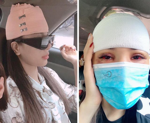 Siêu mẫu Khả Trang bị tai nạn hy hữu phải khâu 10 mũi - Ảnh 1. Siêu mẫu Khả Trang bị tai nạn hy hữu phải khâu 10 mũi - Ảnh 1.