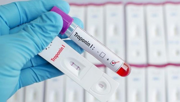 
Abbott’s Hs Troponin-I Test
