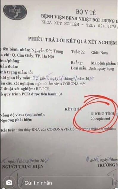 Xuất hiện kết quả xét nghiệm dương tính với nCoV giả mạo - Ảnh 1.